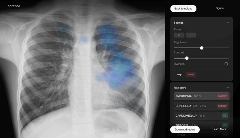 Carebot – případová studie